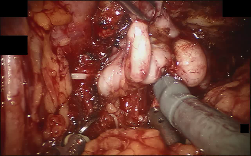SurgVLM